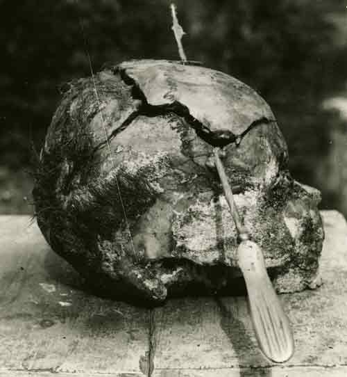 Cat ref: WO 309/215. Forensic photo of one of the British POW victims