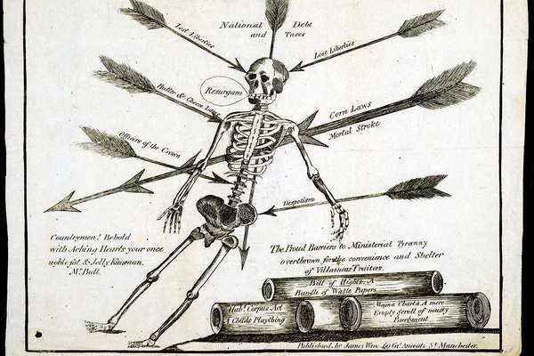 An illustration of a skeleton pierced with arrows, each arrow is labelled