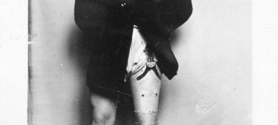 Image of Artificial limbs
