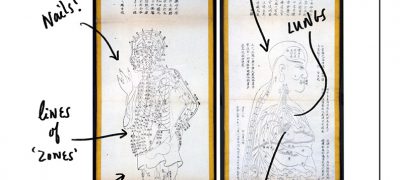 Chinese anatomical diagrams 1857-1859 labelled to show nails, lines of zones, body map, lungs and heart. The question asks what is he feeling?