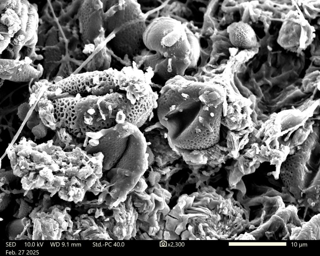 A black and white microscopy image.